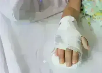 Дете от Лом е в столична болница със съмнение за остра вяла парализа